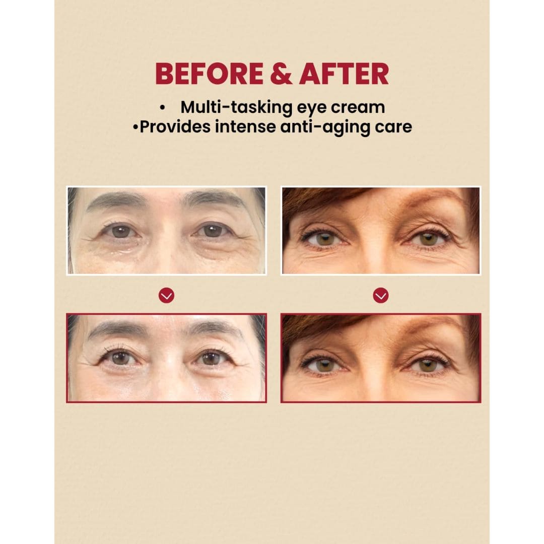 K-SECRET SEOUL 1988 Eye Cream : Retinal Liposome 4% + Fermented Bean