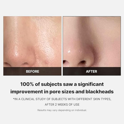 Medicube Zero Pore Pad 2.0 70 discos