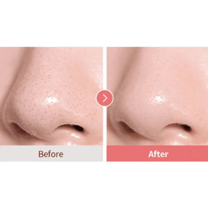 TOCOBO Calamine Pore Control Aceite Limpiador (2ml)